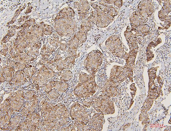 Lipoma-preferred partner LPP Rabbit Polyclonal Antibody