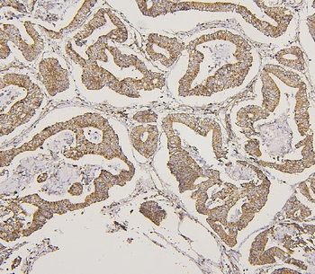 Lipoma-preferred partner LPP Rabbit Polyclonal Antibody