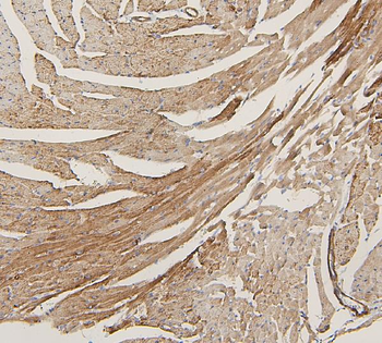 Lipoma-preferred partner LPP Rabbit Polyclonal Antibody