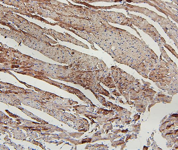 Lipoma-preferred partner LPP Rabbit Polyclonal Antibody