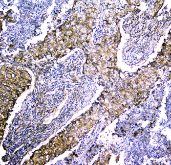 LRTOMT Rabbit Polyclonal Antibody