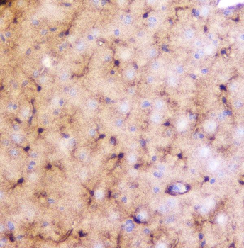 LRTOMT Rabbit Polyclonal Antibody