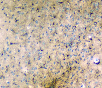 LRTOMT Rabbit Polyclonal Antibody