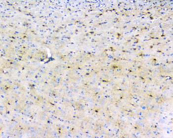 LRTOMT Rabbit Polyclonal Antibody