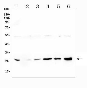LRTOMT Rabbit Polyclonal Antibody