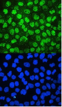 MCM2 Rabbit Polyclonal Antibody
