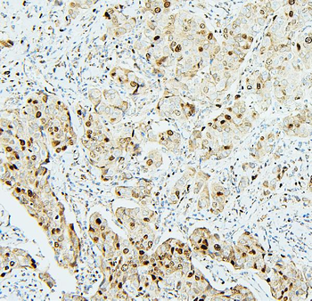 MCM2 Rabbit Polyclonal Antibody