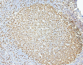 MCM2 Rabbit Polyclonal Antibody