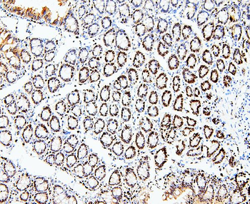 MCM2 Rabbit Polyclonal Antibody