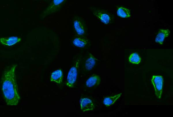 Moesin/MSN Rabbit Polyclonal Antibody