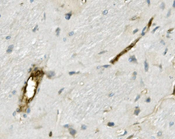 Moesin/MSN Rabbit Polyclonal Antibody