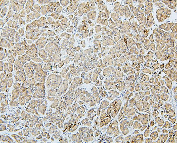 MTR Rabbit Polyclonal Antibody