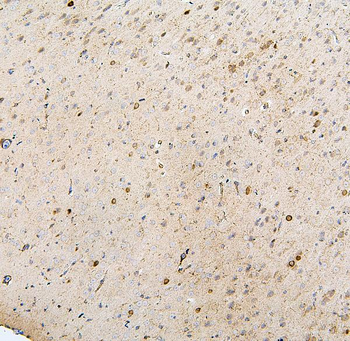 MTR Rabbit Polyclonal Antibody