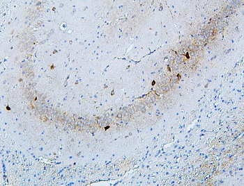 MTR Rabbit Polyclonal Antibody