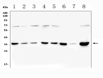 PITX2/RGS Rabbit Polyclonal Antibody
