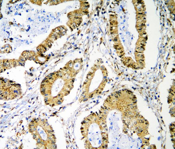PRMT1 Rabbit Polyclonal Antibody