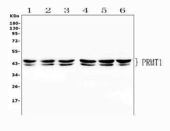 PRMT1 Rabbit Polyclonal Antibody