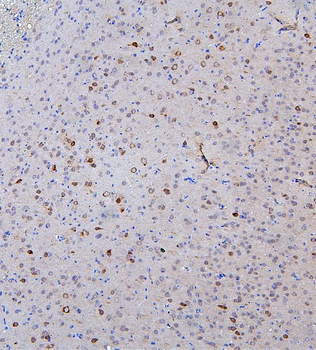 SKP1 Antibody