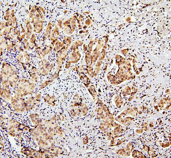 SUZ12 Rabbit Polyclonal Antibody