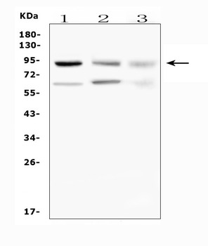 SUZ12 Rabbit Polyclonal Antibody