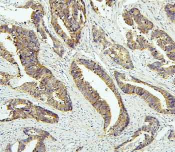 Tafazzin/TAZ Rabbit Polyclonal Antibody