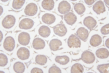 Tafazzin/TAZ Rabbit Polyclonal Antibody