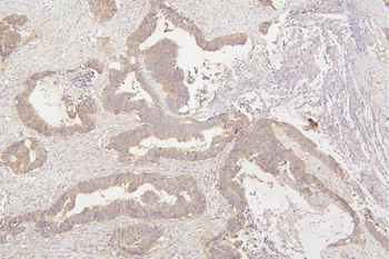 Tafazzin/TAZ Rabbit Polyclonal Antibody