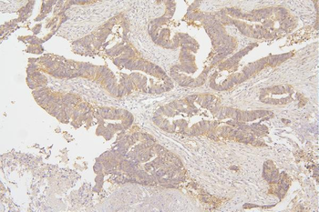 Tafazzin/TAZ Rabbit Polyclonal Antibody
