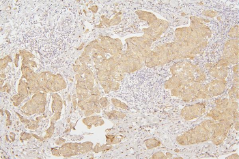 Tafazzin/TAZ Rabbit Polyclonal Antibody