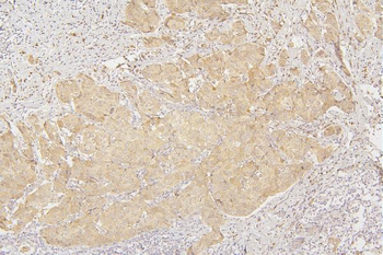 Tafazzin/TAZ Rabbit Polyclonal Antibody