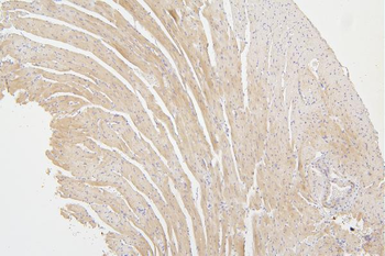 Tafazzin/TAZ Rabbit Polyclonal Antibody