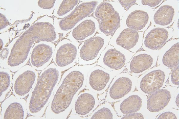 Tafazzin/TAZ Rabbit Polyclonal Antibody