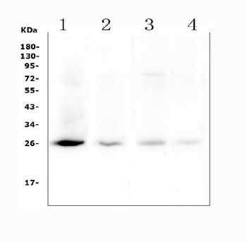 TIMP1 Rabbit Polyclonal Antibody