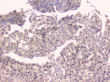 Osteoprotegerin/TNFRSF11B Antibody