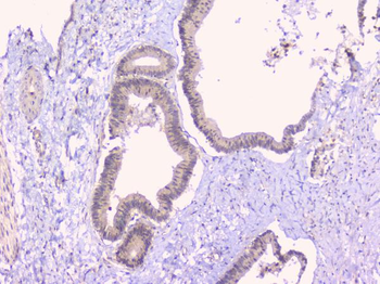 Osteoprotegerin/TNFRSF11B Antibody