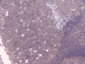 Osteoprotegerin/TNFRSF11B Antibody