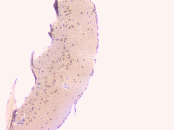 Osteoprotegerin/TNFRSF11B Antibody