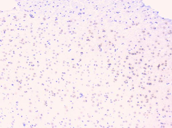 Osteoprotegerin/TNFRSF11B Antibody