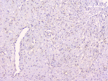 Osteoprotegerin/TNFRSF11B Antibody