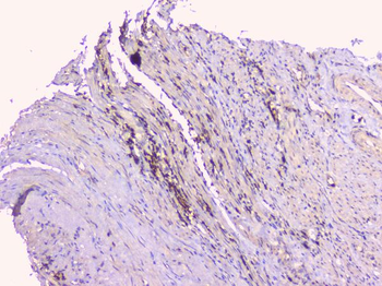 Osteoprotegerin/TNFRSF11B Antibody