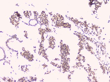 Osteoprotegerin/TNFRSF11B Antibody