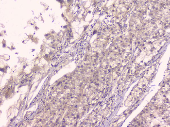 Osteoprotegerin/TNFRSF11B Antibody