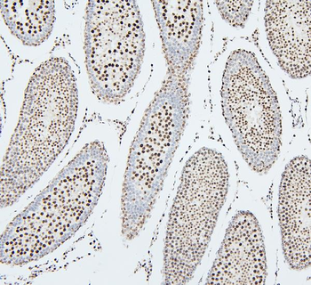 UBE2I/UBC9 Antibody