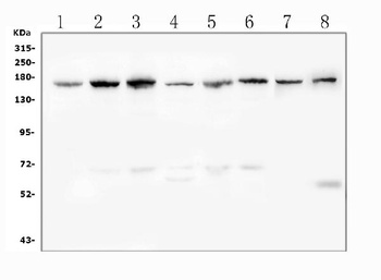 Desmoglein 2/DSG2 Rabbit Polyclonal Antibody