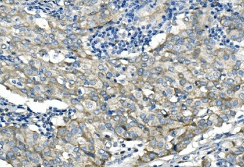 Desmoglein 2/DSG2 Rabbit Polyclonal Antibody
