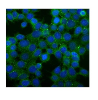 Desmoglein 2/DSG2 Rabbit Polyclonal Antibody