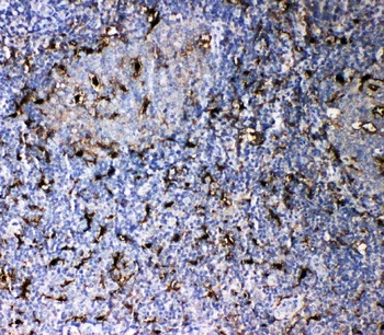 Interleukin-18 IL18/18 Rabbit Polyclonal Antibody
