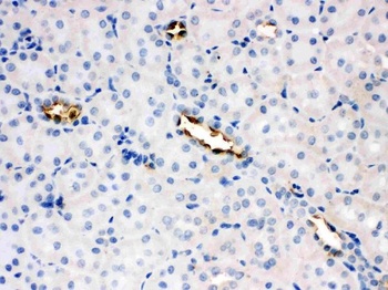 Glucose Transporter 8/SLC2A8 Rabbit Polyclonal Antibody