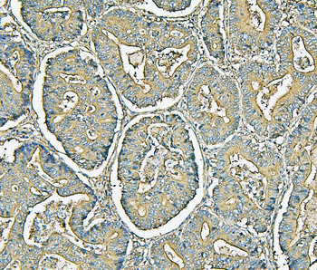 MVP Antibody (monoclonal, 8B12)