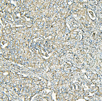 MVP Antibody (monoclonal, 8B12)